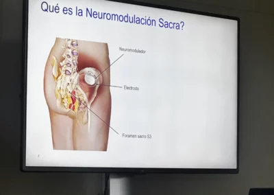 Jornada de información Hospital del Mar